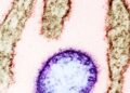 India on high alert due to virus identified as possible next pandemic