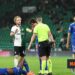 AVS: Baroan fractured tibia and fibula in Alvalade