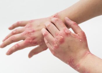 “Do you get sore fingers from the cold? That’s what you have to do”